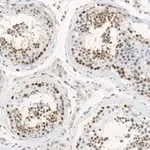 Merck Anti-MGMT Antibody, clone 2N19 ZooMAb Rabbit Monoclonal