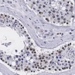 Merck Anti-Smad1 Antibody, clone 1B9 ZooMAb Rabbit Monoclonal