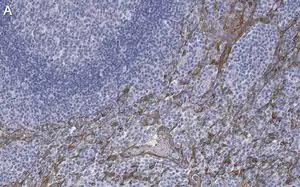 Merck Anti-Cytokeratin 5/6 Antibody, clone D5/16 B4 ZooMAb Mouse Monoclonal