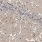 Merck Anti-PSD95 Antibody, clone K28/43 ZooMAb Mouse Monoclonal