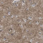 Merck Anti-K+/Cl- Cotransporter-2 Antibody, clone 5E13 ZooMAb Rabbit Monoclonal