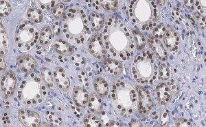 Merck Anti-HNF-1β Antibody, clone 1M22 ZooMAb Rabbit Monoclonal