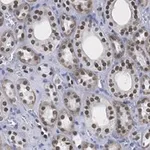 Merck Anti-HNF-1β Antibody, clone 1M22 ZooMAb Rabbit Monoclonal