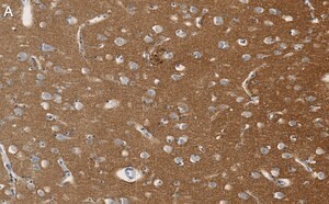 Merck Anti-SNAP-25 Antibody, clone 1J9 ZooMAb Rabbit Monoclonal