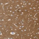 Merck Anti-SNAP-25 Antibody, clone 1J9 ZooMAb Rabbit Monoclonal