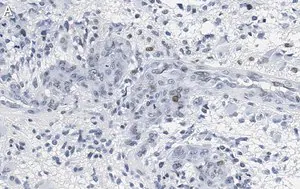 Merck Anti-p-PTEN (Tyr240) Antibody, clone 3G6 ZooMAb Rabbit Monoclonal