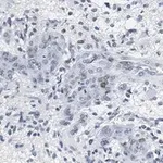 Merck Anti-p-PTEN (Tyr240) Antibody, clone 3G6 ZooMAb Rabbit Monoclonal