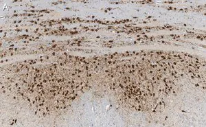 Merck Anti-Calretinin Antibody, clone 6B8.2 ZooMAb Mouse Monoclonal