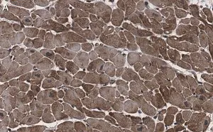 Merck Anti-CACNA1C Antibody, clone 1F20 ZooMAb Rabbit Monoclonal