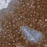 Merck Anti-Involucrin Antibody, clone 1D13 ZooMAb Rabbit Monoclonal