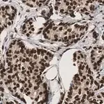 Merck Anti-53BP1 Antibody, clone BP13 ZooMAb Mouse Monoclonal