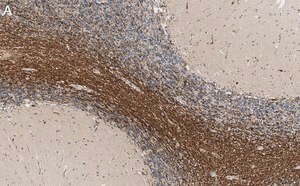 Merck Anti-Bin1 Antibody, clone 99D.2 ZooMAb Mouse Monoclonal