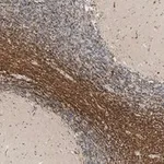 Merck Anti-Bin1 Antibody, clone 99D.2 ZooMAb Mouse Monoclonal