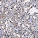 Merck Anti-PP2A C subunit Antibody, clone 2B15 ZooMAb Rabbit Monoclonal