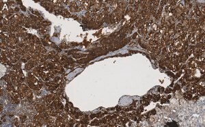 Merck Anti-Clusterin α chain Antibody, clone 41D ZooMAb Mouse Monoclonal