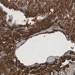 Merck Anti-Clusterin α chain Antibody, clone 41D ZooMAb Mouse Monoclonal