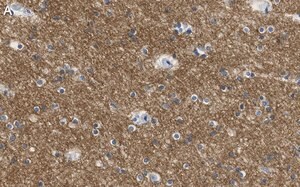 Merck Anti-KCNQ2 Antibody, clone 2G18 ZooMAb Rabbit Monoclonal