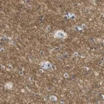 Merck Anti-KCNQ2 Antibody, clone 2G18 ZooMAb Rabbit Monoclonal