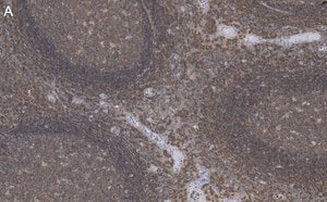 Merck Anti-Talin-1 Antibody, clone 2F8 ZooMAb Rabbit Monoclonal