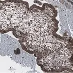 Merck Anti-NF-kB p65 subunit Antibody, clone 1D8 ZooMAb Rabbit Monoclonal