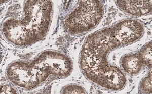 Merck Anti-METTL7A Antibody, clone 1O8 ZooMAb Rabbit Monoclonal