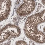 Merck Anti-METTL7A Antibody, clone 1O8 ZooMAb Rabbit Monoclonal