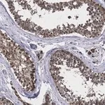 Merck Anti-TSTA3 Antibody, clone 2N10-H1 ZooMAb Rabbit Monoclonal