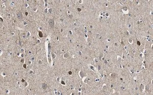 Merck Anti-GAD67 Antibody, clone 4B5 ZooMAb Rabbit Monoclonal