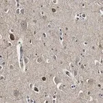 Merck Anti-GAD67 Antibody, clone 4B5 ZooMAb Rabbit Monoclonal