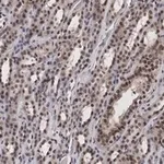 Merck Anti-MLL/HRX CT Antibody, clone 5C15 ZooMAb Rabbit Monoclonal