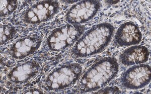 Merck Anti-Mn-SOD Antibody, clone 1C14 ZooMAb Rabbit Monoclonal