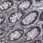 Merck Anti-Mn-SOD Antibody, clone 1C14 ZooMAb Rabbit Monoclonal