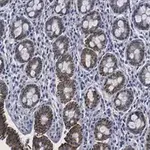 Merck Anti-Tubulin γ-2 Antibody, clone 1M19 ZooMAb Rabbit Monoclonal