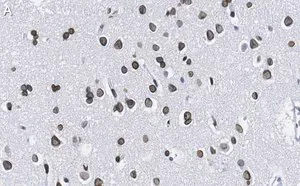 Merck Anti-Lamin A/C Antibody, clone 2B10 ZooMAb Rabbit Monoclonal