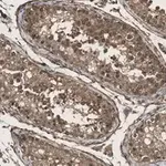 Merck Anti-KLF5 Antibody, clone 1J12 ZooMAb Rabbit Monoclonal