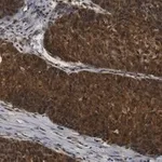 Merck Anti-ANKZF1 Antibody, clone 1D4 ZooMAb Rabbit Monoclonal