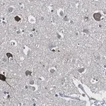 Merck Anti-Prion Protein Antibody, clone 3D17 ZooMAb Rabbit Monoclonal
