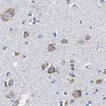 Merck Anti-CGRP-1 Antibody, clone 2E18 ZooMAb Rabbit Monoclonal