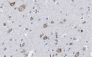 Merck Anti-CGRP-1 Antibody, clone 2E18 ZooMAb Rabbit Monoclonal