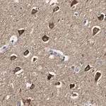 Merck Anti-CaM Kinase IIα Antibody, clone 1C20 ZooMAb Rabbit Monoclonal