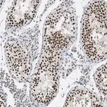 Merck Anti-HDAC2 Antibody, clone 1E22 ZooMAb Rabbit Monoclonal