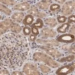 Merck Anti-TSC2 Antibody, clone 4H10 ZooMAb Rabbit Monoclonal