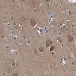 Merck Anti-Catenin-α 2 Antibody, clone 3F7 ZooMAb Rabbit Monoclonal