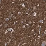 Merck Anti-α-synuclein Antibody, clone 1D22 ZooMAb Rabbit Monoclonal