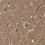 Merck Anti-Tau Antibody, clone 3D20 ZooMAb Rabbit Monoclonal