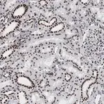 Merck Anti-53BP1 Antibody, clone 1H16 ZooMAb Rabbit Monoclonal