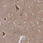 Merck Anti-BSN Antibody, clone 2I2 ZooMAb Rabbit Monoclonal