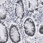 Merck Anti-ZNF638 Antibody, clone 4C19 ZooMAb Rabbit Monoclonal