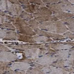 Merck Anti-ACAD10 Antibody, clone 3J20 ZooMAb Rabbit Monoclonal