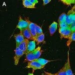 Merck Anti-GABA A Receptor α1 Antibody, clone 3H10 ZooMAb Rabbit Monoclonal